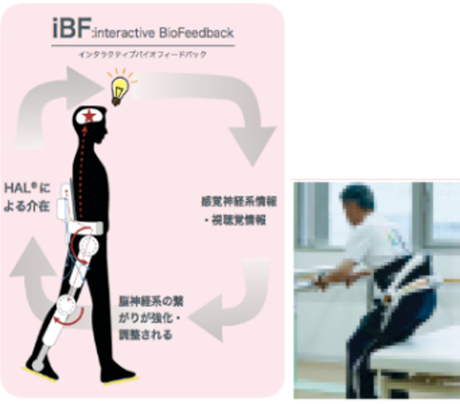 装着型ロボットリハビリテーション