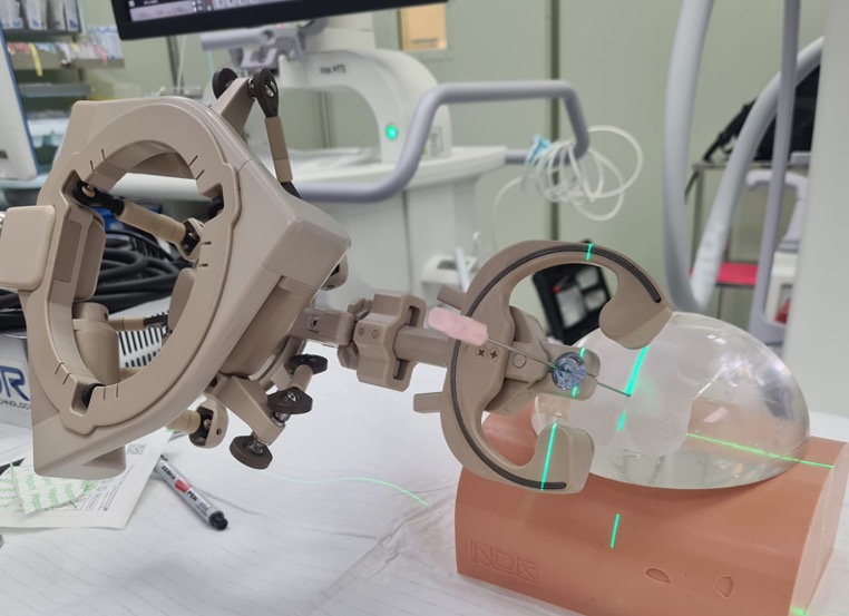 This is the Automated Needle Targeting with X-ray (ANT-X), which was utilized for the robotic-assisted fluoroscopic guidance in percutaneous nephrolithotomy. This study presents the results of the clinical trial using the ANT-X.