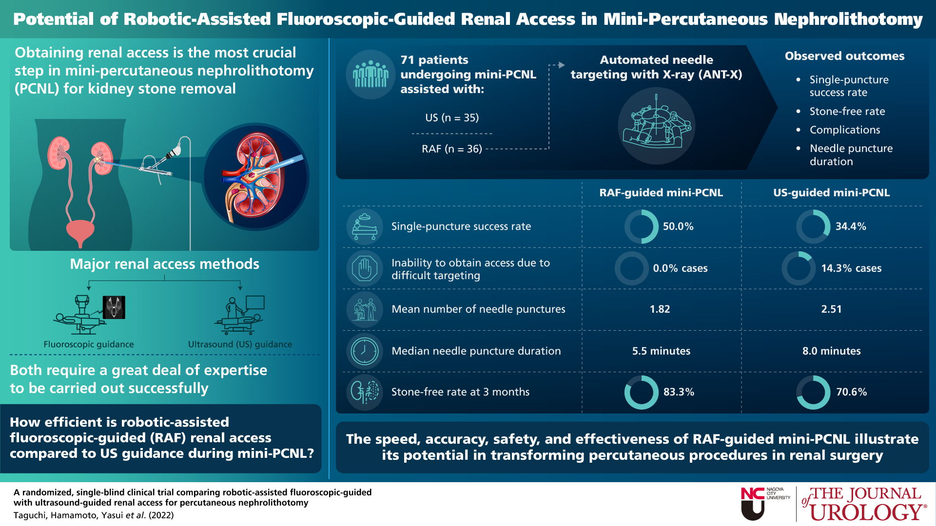 This is the visual abstract of the randomized, single-blind clinical trial comparing the surgical outcomes of robotic-assisted fluoroscopic-guided and ultrasound-guided renal access in mini-percutaneous nephrolithotomy (PCNL).