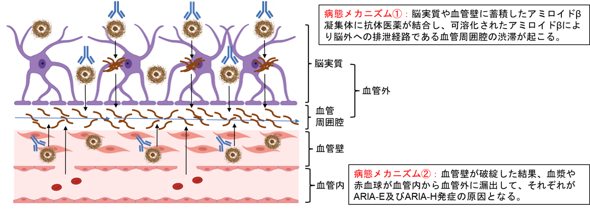 図1 血液脳関門におけるARIA発症の病態メカニズム