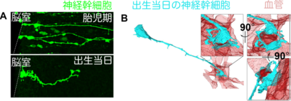 図2：出生当日の神経幹細胞の構造的変換