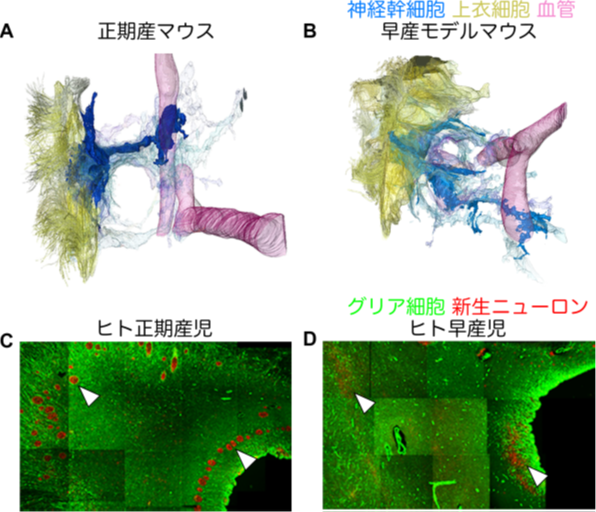 図3：早産によって乱れる脳室下帯の構造　