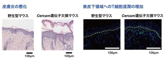 図3：Cercam遺伝子欠損マウスにおける乾癬様皮膚炎の増悪
