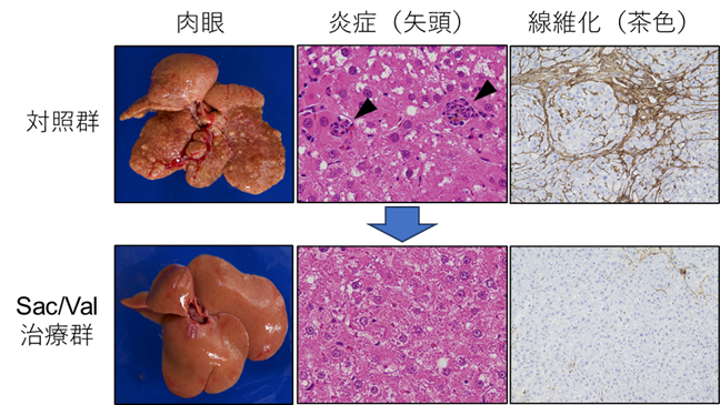 図1.「Sac/Val」治療により、肝臓の炎症と線維化が改善した。