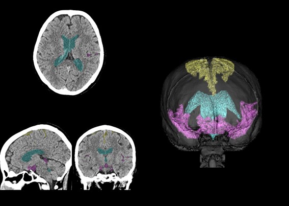 研究に関する画像