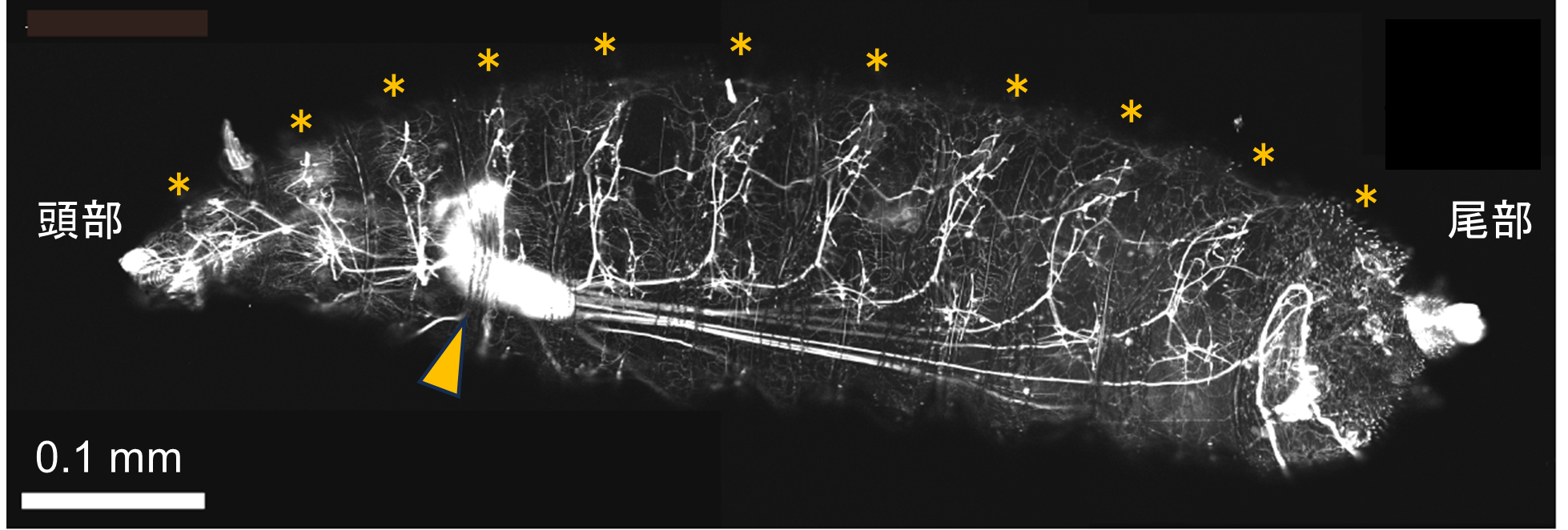 エーテルリン脂質ePLの合成酵素が神経に豊富に存在する