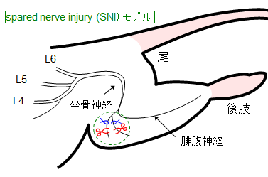 画像１