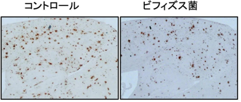 ビフィズス菌MCC1274を4カ月間経口摂取させたマウス脳内では、アルツハイマ―病の原因分子Aβ沈着が低下した