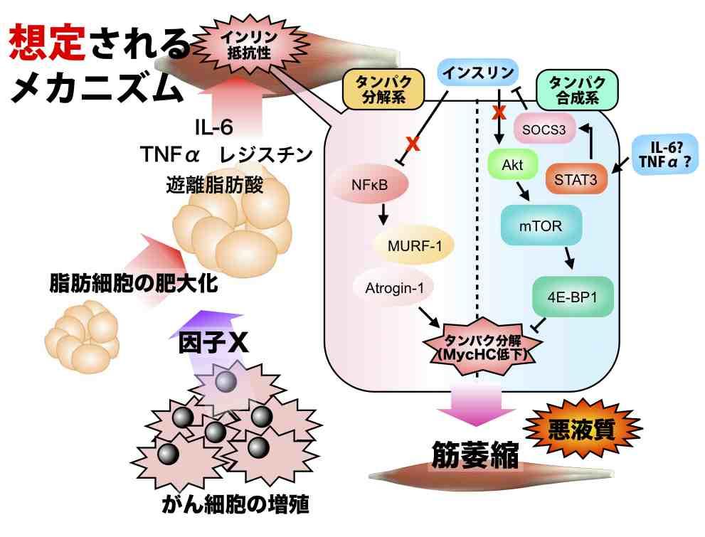 Cachexy in Cancer Patients