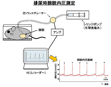 排尿時膀胱内圧測定