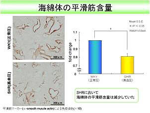 海綿体の平滑筋含量